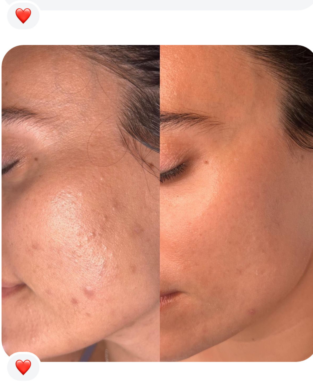 REPAIRING FACE OIL
