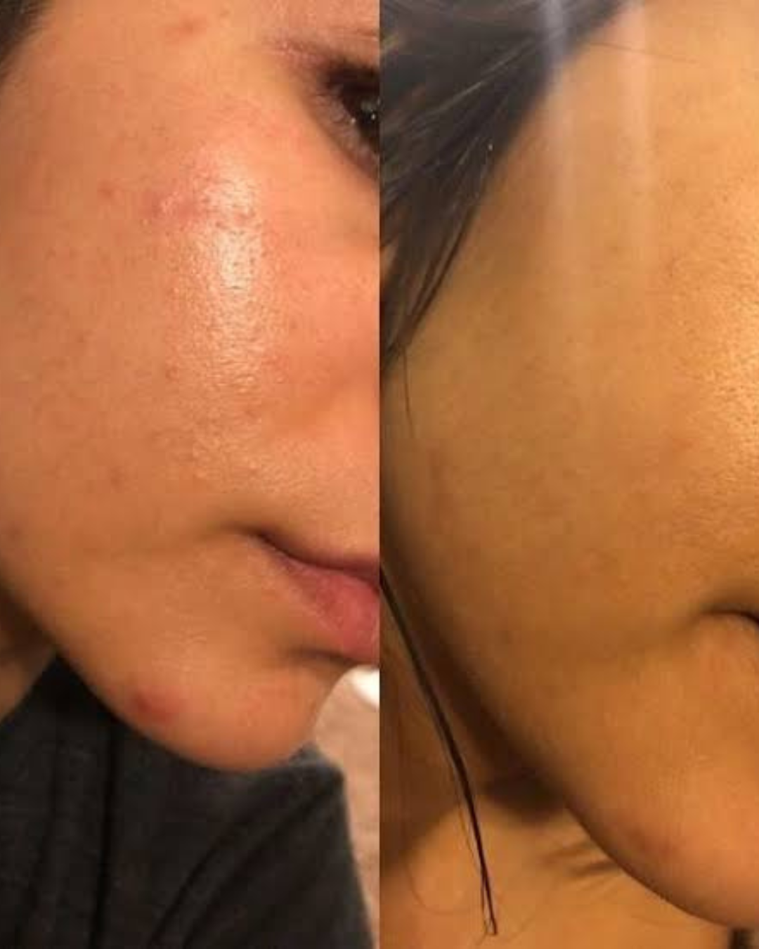 REPAIRING FACE OIL