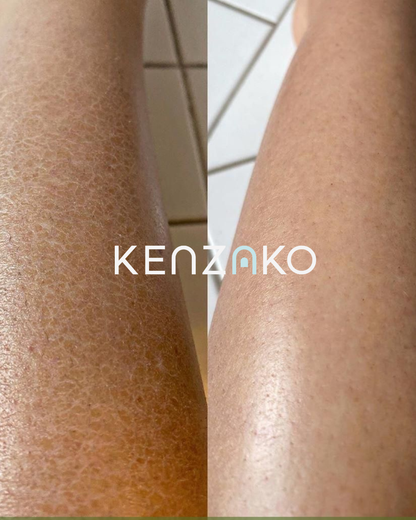 AHA Body Reset Scrub - Exfoliating Body Scrub for Smooth Skin &amp; KP Treatment